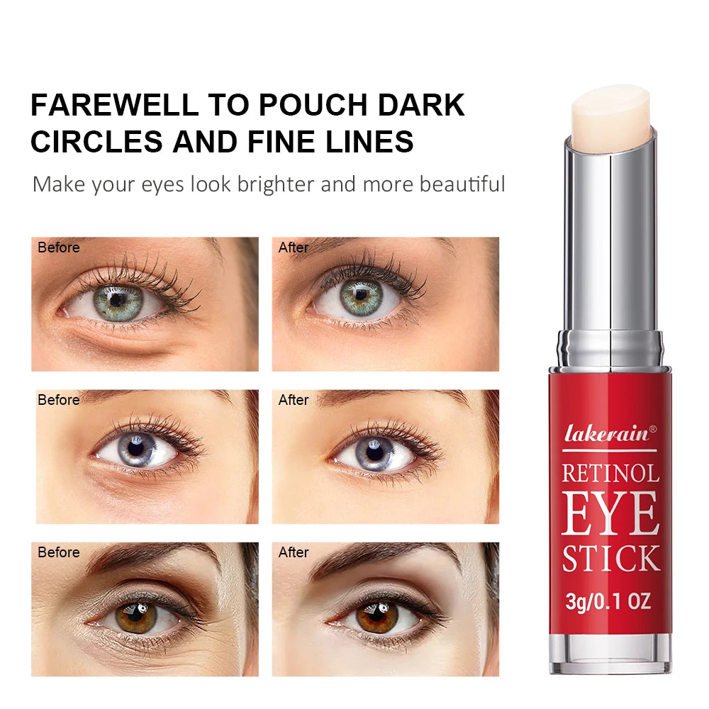 Retinol Brightening Eye Cream — Dark Circle & Firming Serum Stick