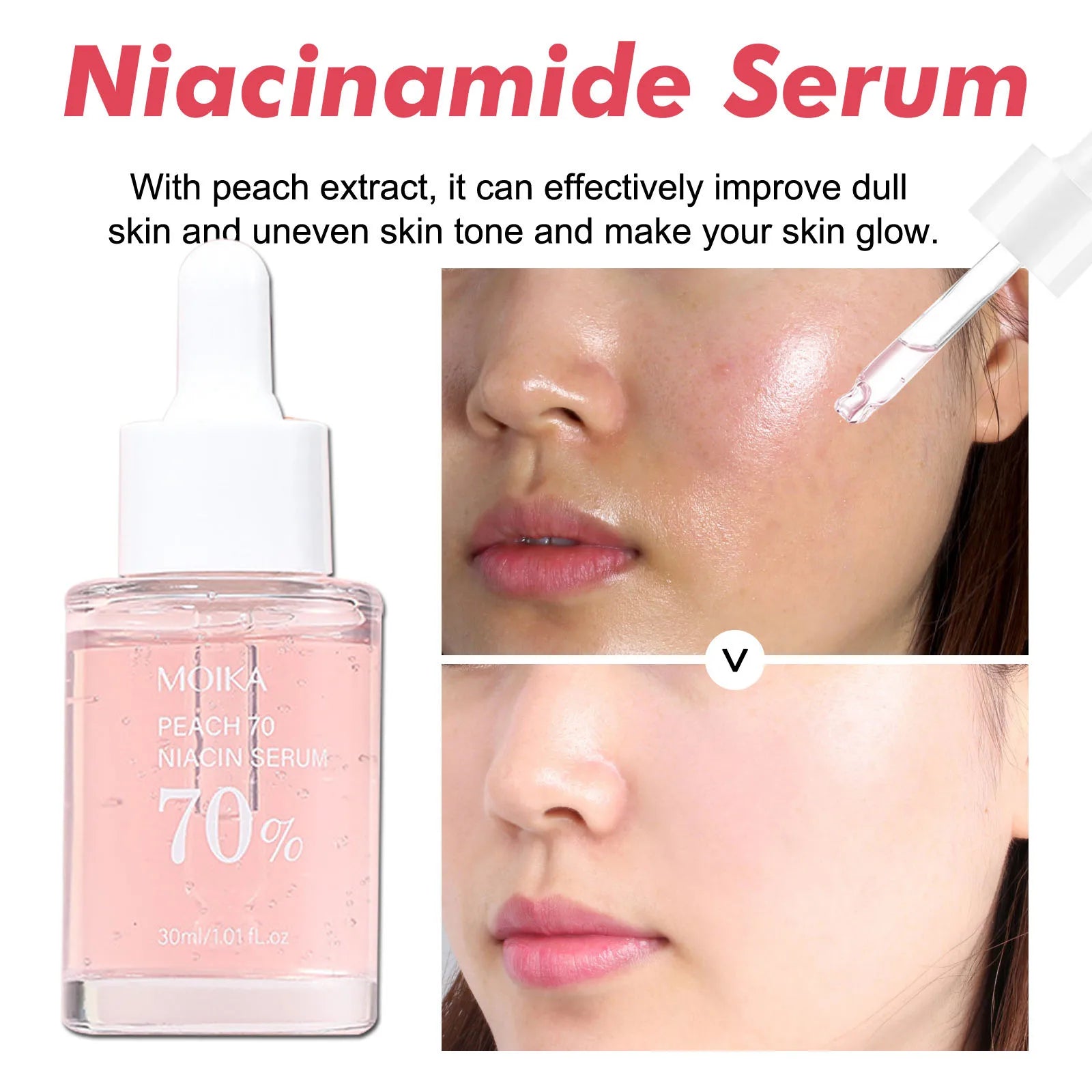 Niacinamide Dark Spot Correcting Serum — Pore Refining & Even Tone