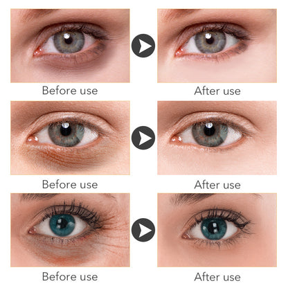 Hydrating Eye Cream for Women — 30ml Anti-Ageing Skin Care