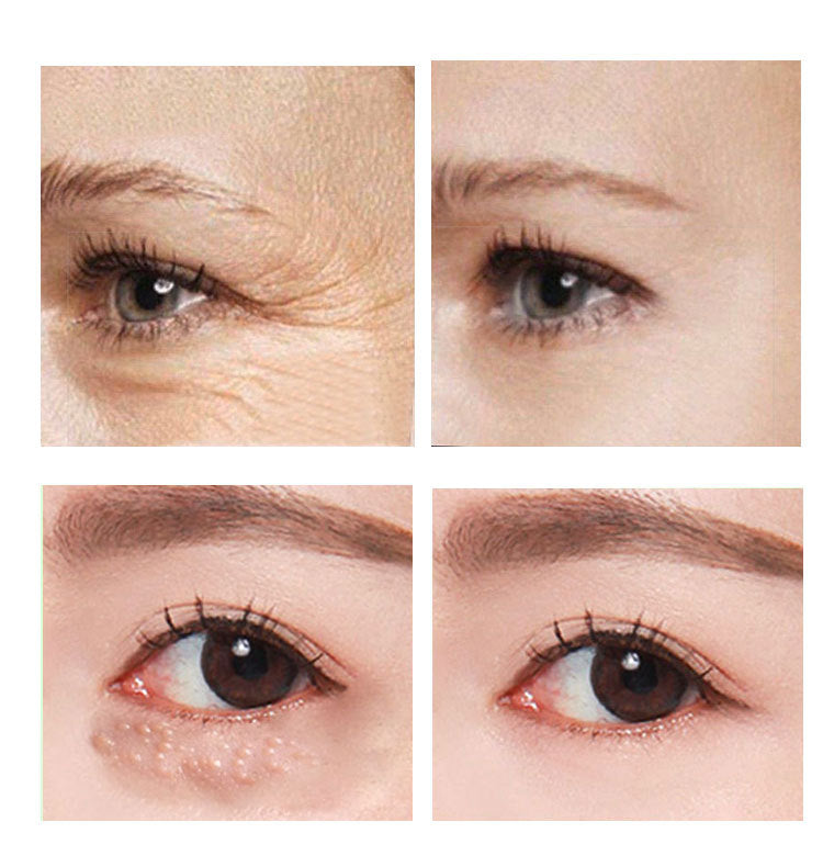 Hydrating Eye Cream for Women — 30ml Anti-Ageing Skin Care