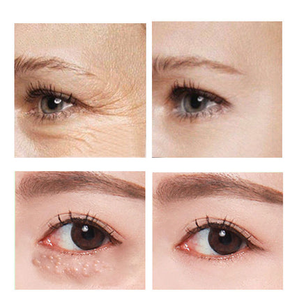 Hydrating Eye Cream for Women — 30ml Anti-Ageing Skin Care